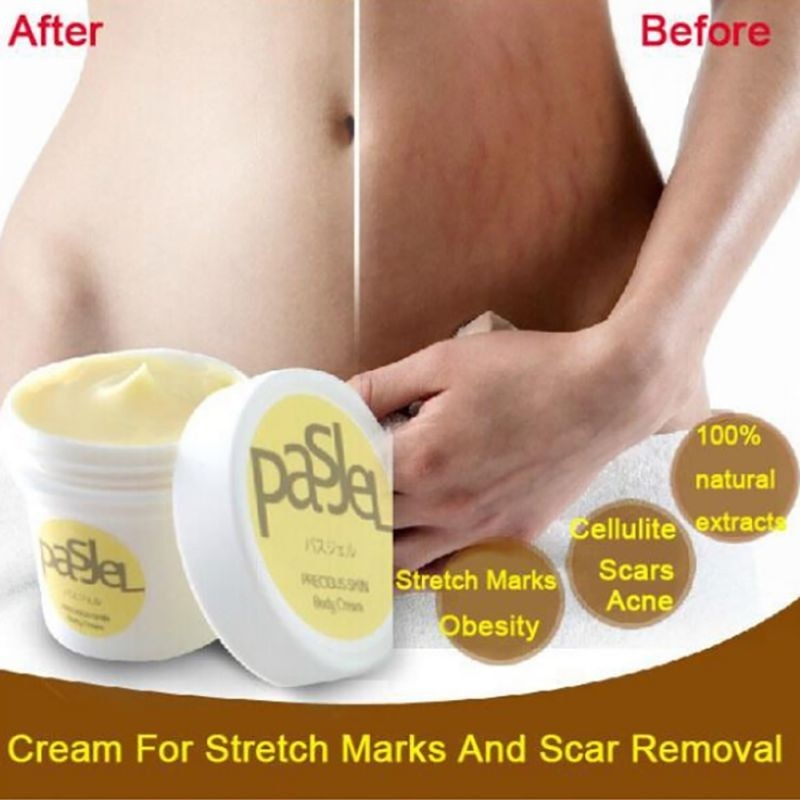 50g Pregnancy Repairing Cream