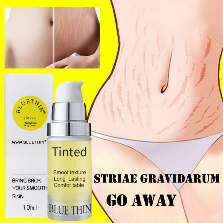 Maternity Stretch Marks Repair Cream