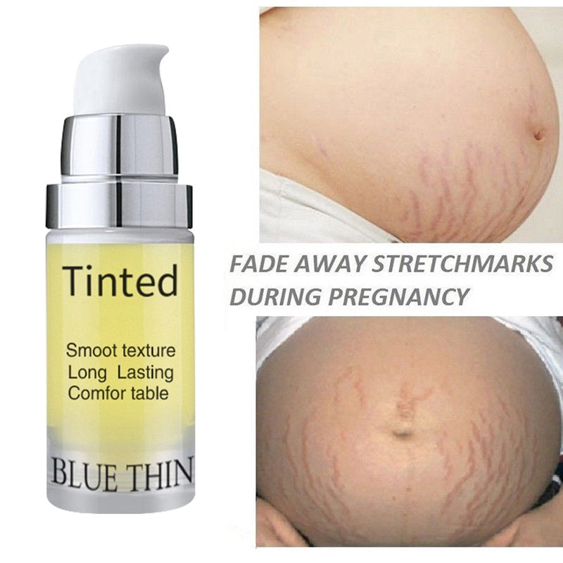 Maternity Stretch Marks Repair Cream